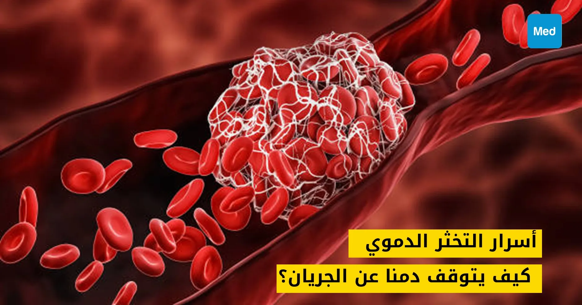 أسرار التخثر الدموي: كيف يتوقف دمنا عن الجريان